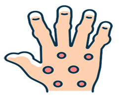 Psoriasis icon